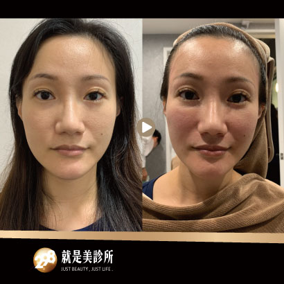 410x410-玻3.jpg 410x410-玻3.jpg