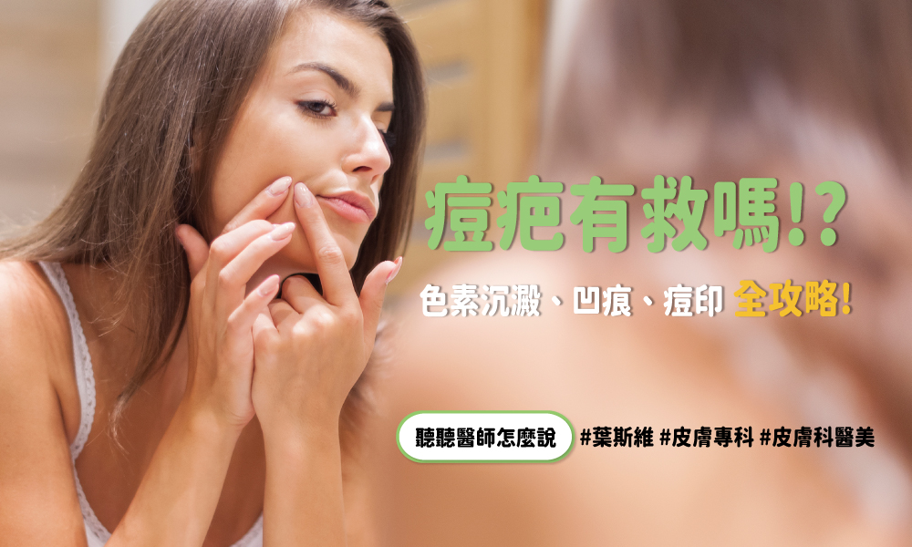 298就是美診所-痘痘全攻略