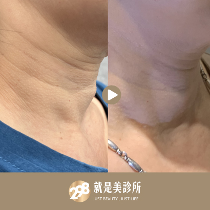 逆時針-脖子.jpg 逆時針-脖子.jpg