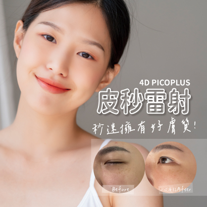 皮秒.jpg 皮秒.jpg
