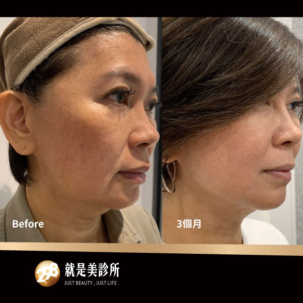 610x610-4.jpg 610x610-4.jpg