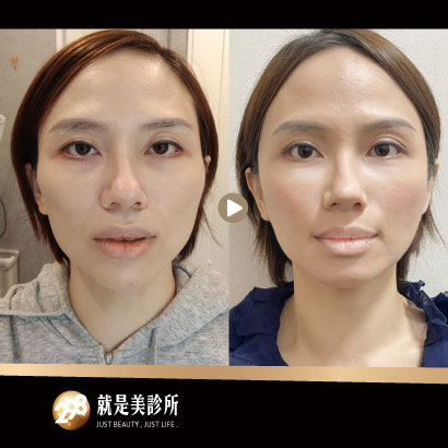 410x410-玻1.jpg 410x410-玻1.jpg