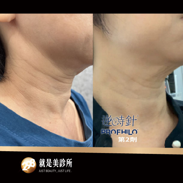 BA照-610x610-逆時針.jpg BA照-610x610-逆時針.jpg