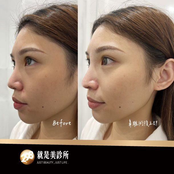 BA照-610x610-鼻雕.jpg