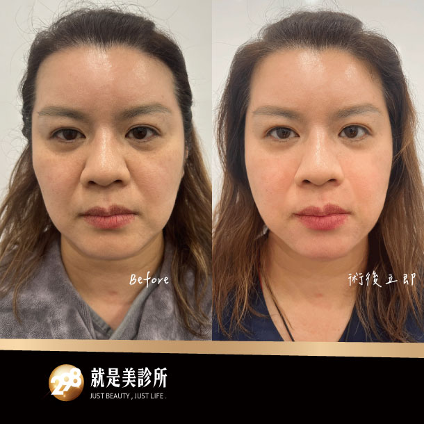 BA照-610x610-德瑪芙2.jpg