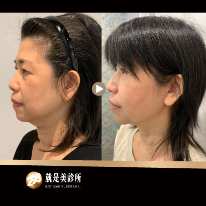 BA照-410x410-雙3.jpg
