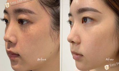 麗珠蘭-298就是美-案例