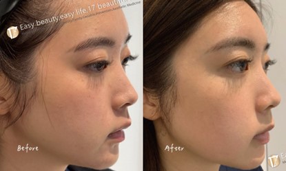 麗珠蘭-298就是美-案例