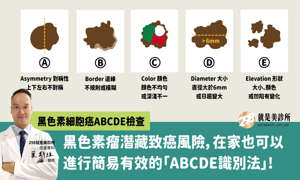 痣的檢查-298就是美診所